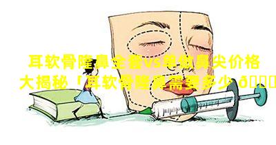 耳软骨隆鼻全套vs单做鼻尖价格大揭秘「耳软骨隆鼻需要多少 🐒 耳软骨」